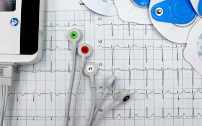 Prueba de esfuerzo y Holter: ¿cuándo son necesarios y por qué pueden salvar tu corazón?